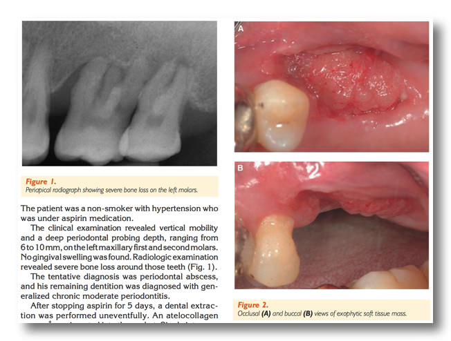 扁平上皮癌の症状