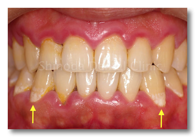 どのような症状がありますか?