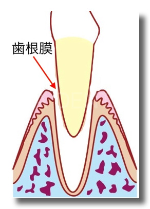 脱落歯　歯根膜